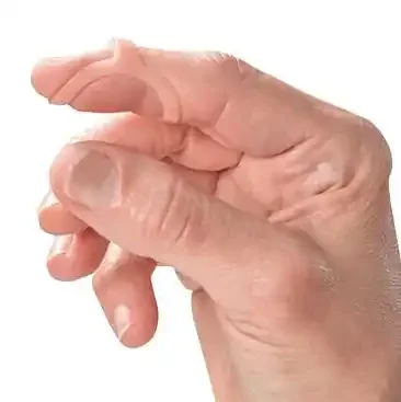 3 Point Products Oval-8 Finger Splint Oval Ring Style Plastic Finger Translucent – P1008-K