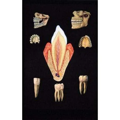 3B Anatomical Chart – Healthy Denture Chart 33.1 x 46.5″