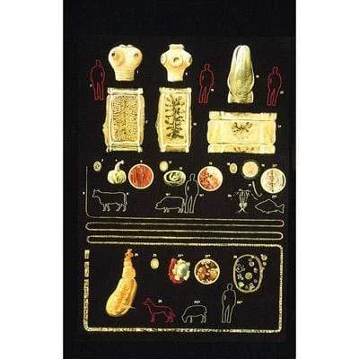 3B Anatomical Chart – Intestinal Parasites Chart 33.1 x 46.5 in