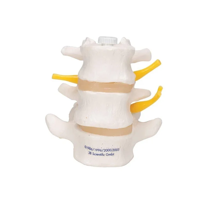 3B Anatomical Model – 3 Human Lumbar Vertebrae, Flexibly Mounted