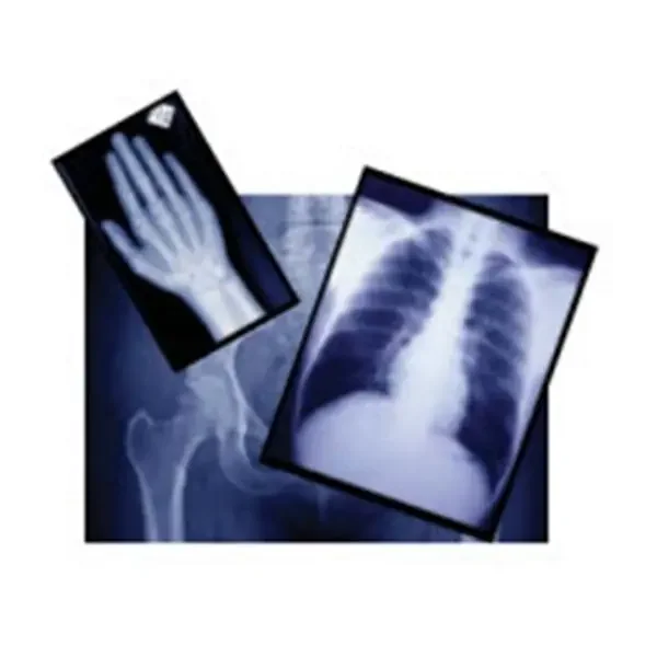 Agfa Corporation Film X-Ray Radiomat Gplus 8X10″ 100/Box – EZP2B