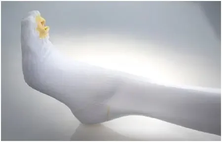 Alba Healthcare Ultra C.A.R.E Anti-embolism Stockings Knee High Medium / Regular Open Toe – 853-02