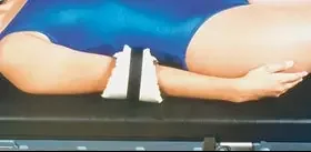 Alimed AliMed Ulnar Protector Alimed – 95-787