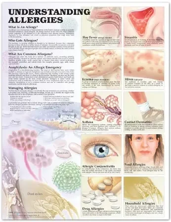 Anatomical Chart Company Anatomical Chart Allergies 20 X 26 Inch Heavy Paper Grommets Laminated – 9781587799402
