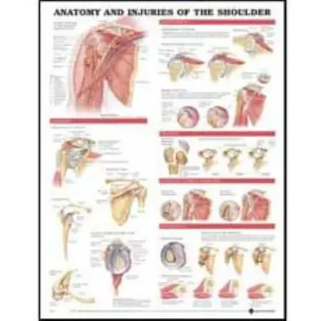 Anatomical Chart Company Anatomical Chart Anatomy and Injuries of the Shoulder 20 X 26 Inch Styrene Plastic – 9781587798092