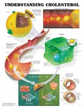 Anatomical Chart Company Anatomical Chart Understanding Cholesterol 20 X 26 Inch Plastic Wall Mount Laminated – 9781587793264