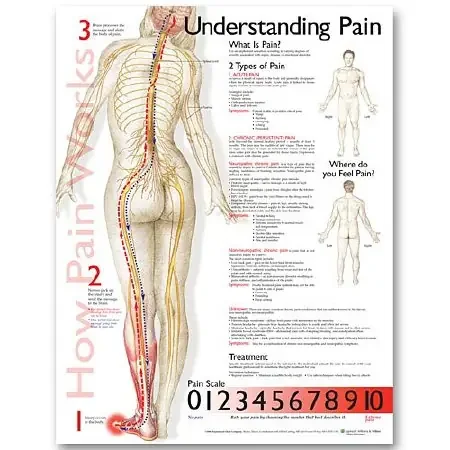 Anatomical Chart Company Anatomical Chart Understanding Pain 20 X 26 Inch Plastic Wall Mount Laminated – 9781587799846