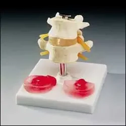 Anatomical Chart Company Lumbar Vertebrae Model Plastic – CH76