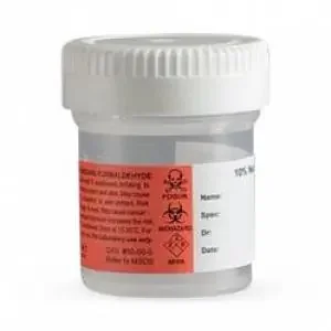 Cardinal SP Prefilled Formalin Container Polypropylene Screw Cap 7.5 mL Fill in 15 mL (0.5 oz.) NonSterile – C4320-7.5B