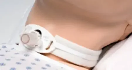 Marpac Tracheostomy Collar – 204D