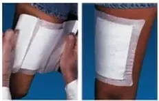 MPM Medical WoundGard Adhesive Dressing 6 X 8 Inch Gauze Rectangle White Sterile – P00099C