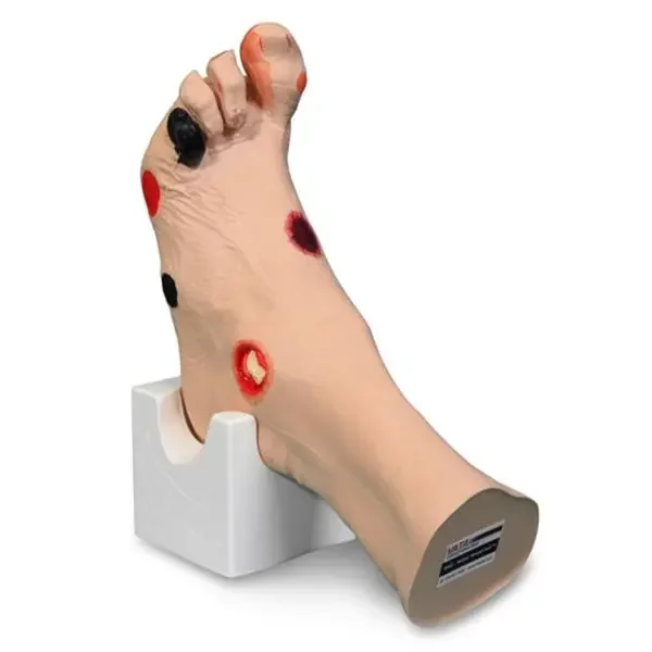 Nasco Company Model Anatomical Wilma Wound Foot Each – SB46503U