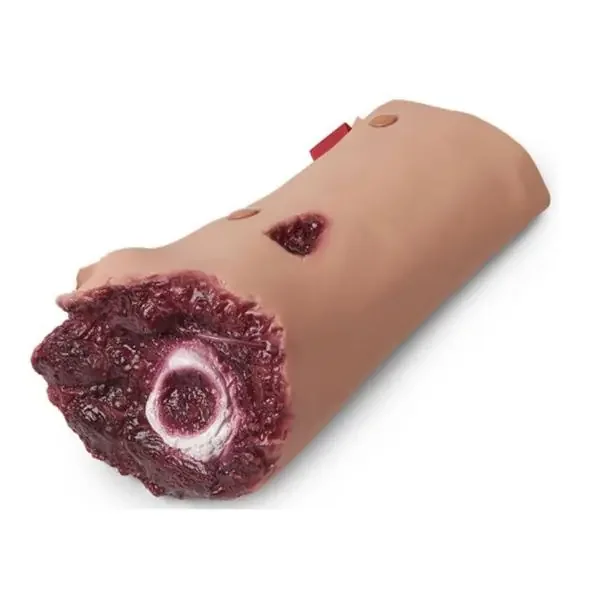 Nasco Company Moulage Training Leg Amputation Ea – 800-6760