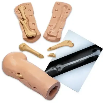 Nasco Life/Form Imaging Fracture Simulator – LF01210