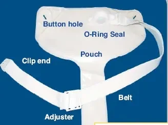 Nu-Hope Laboratories Ileostomy Set Right Drainable – EV6110-000
