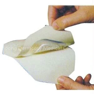 Opsite Flexifix Transparent Adhesive Film Roll, 2″ X 11 Yds.