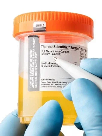 Thermo Scientific Nalge – Specimen Collection & Containers