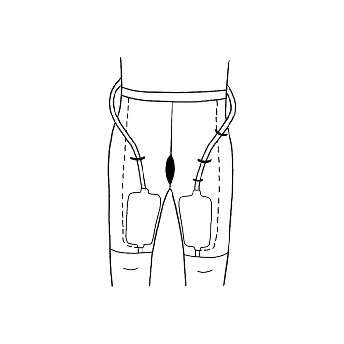 Uro Concepts Inc. Urinary Suspensory System, Xx-large, 36 Per Case