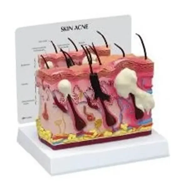 Wards Natural Science Model Skin Gpi Anatomicals Ea – 470160-270