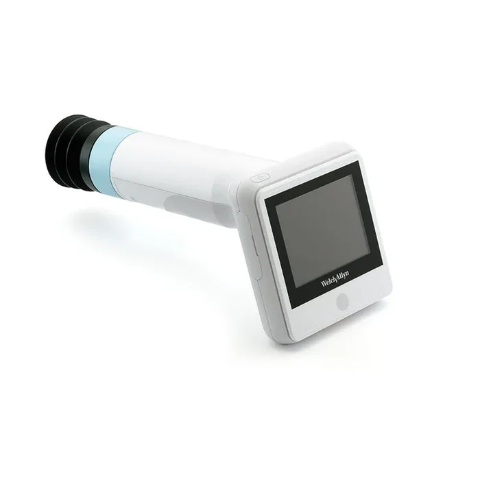 Welch Allyn Handheld RetinaVue 100 Imager – RV100-B