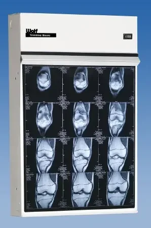Wolf X-Ray Trimline Basic X-Ray Illuminator 2 Bank 2 Tier 2 Lamp Wall Mount – 29511