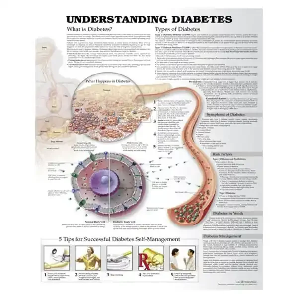 Wolters Kluwer Health Inc Chart Educational Understanding Diabetes Ea – 9781469894928
