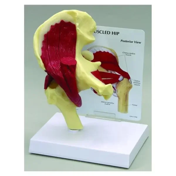 Wolters Kluwer Health Inc Muscled Hip Joint Model Anatomical Ea – G131
